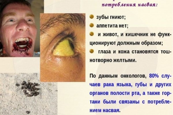 Кракен не работает сегодня